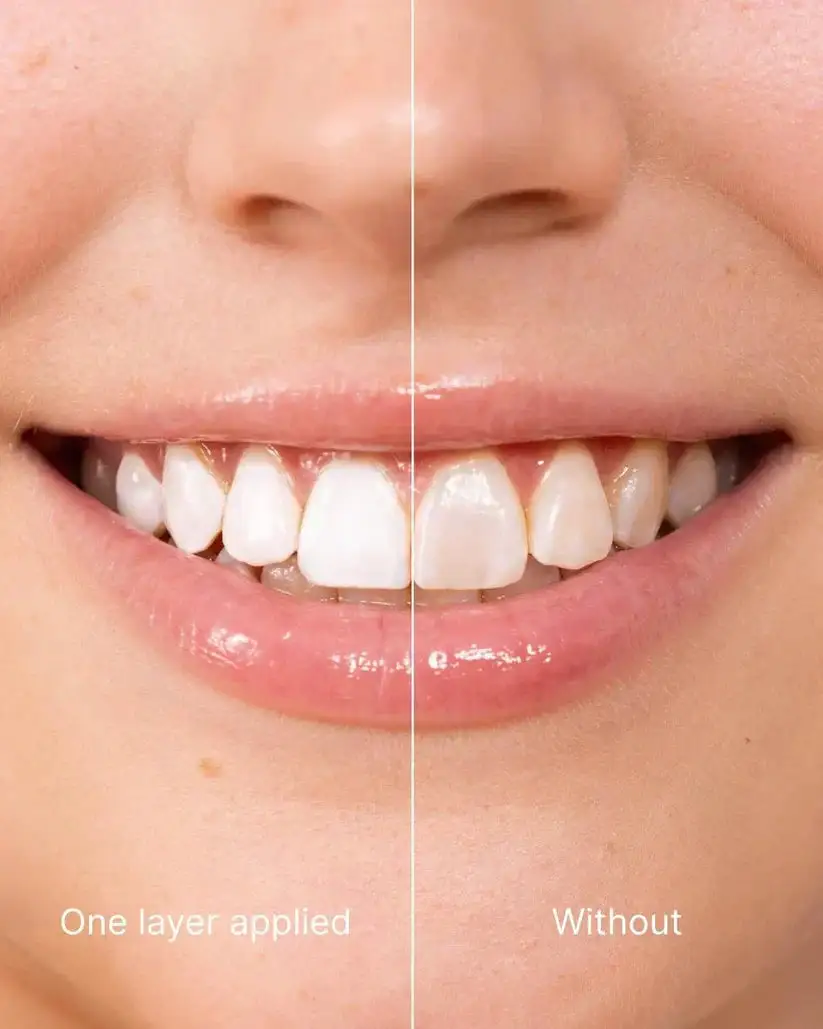 Misspone™ Tooth Polish - Instant Clean Smile