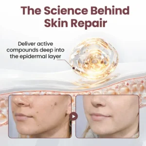 Misspone® KeraErase Dual-Action Renewal Cream